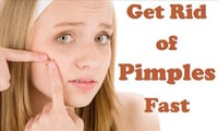 Natural home remedies to get rid of pimples 